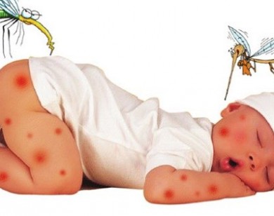 Cách đơn giản xóa vết thâm do muỗi đốt cho trẻ 