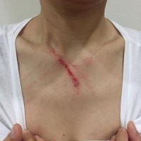 Nhắc nhở cặp vợ chồng khạc nhổ trong thang máy, một bà bầu bị đánh dã man