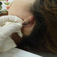 Làm tóc đón Tết, người bị hoại tử vành tai, kẻ bị mất da đầu