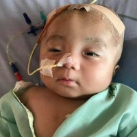 Hàng triệu người bật khóc khi biết tin bé trai bị não úng thủy bị bỏ rơi đã hết cách cứu chữa