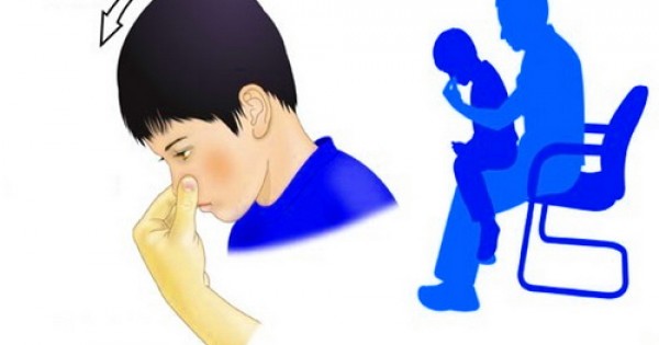Trẻ chảy máu mũi và cách xử trí