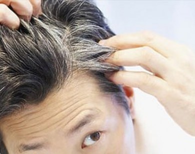 Cách chữa tóc bạc sớm đơn giản mà hiệu quả không ngờ chỉ chưa tới 1 ngàn đồng