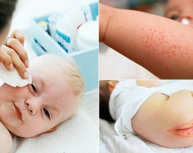 Mẹ dùng giấy ướt cho con - sai lầm từ thói quen nhỏ, hậu quả khôn lường