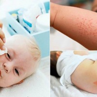 Mẹ dùng giấy ướt cho con - sai lầm từ thói quen nhỏ, hậu quả khôn lường