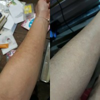 Phòng tránh triệu chứng da khô mùa nắng nóng