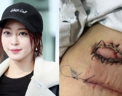 Phẫu thuật "lỗi" cho nữ diễn viên Hàn, bệnh viện lên tiếng