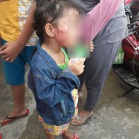 Bắt khẩn cấp cô giáo đánh trẻ "nứt xương hàm" ở TP Hồ Chí Minh