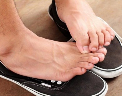 4 cách chữa hôi chân bạn không được quên