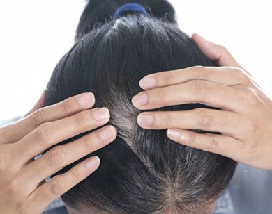 3 cách chữa tóc bạc sớm bạn phải biết