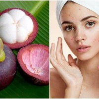 Vỏ măng cụt - nguyên liệu làm đẹp từ thiên nhiên