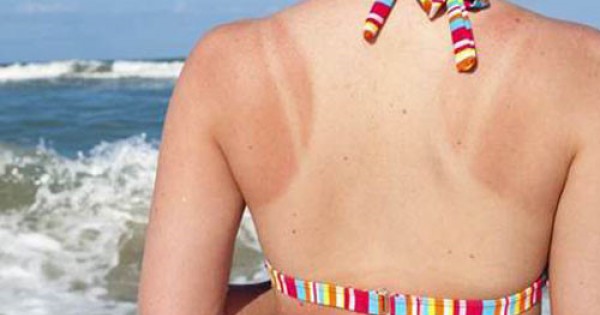 Bạn đã biết cách để làn da không bắt nắng?