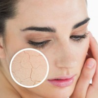 4 dấu hiệu chứng tỏ làn da bị lão hóa sớm