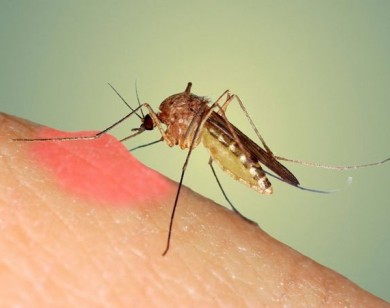 Nhóm máu nào hay bị muỗi tấn công nhất?