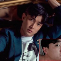 Quốc Trường lên tiếng vì nghi vấn sửa mũi