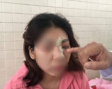 Tiêm filler nâng mũi cô gái 21 tuổi bị mù mắt