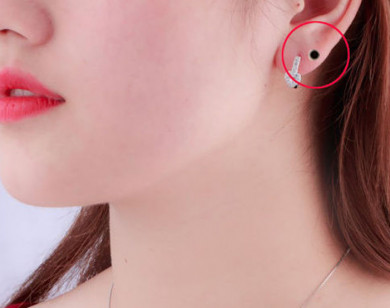 Nốt ruồi ở tai cho biết trước tương lai giàu có sung túc an nhàn của bạn