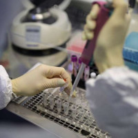 Thanh tra vụ mua máy xét nghiệm Covid-19 giá 7,2 tỷ đồng