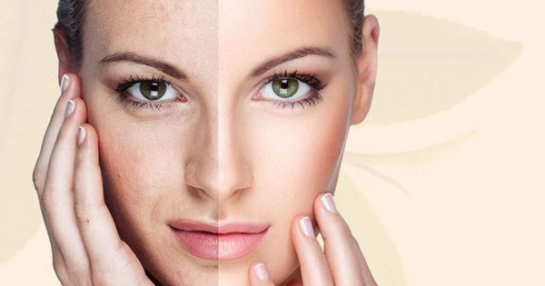 3 dấu hiệu cho thấy bạn đang chăm sóc da sai cách