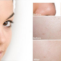 Lỗ chân lông se khít chỉ bằng cách sử dụng rau răm