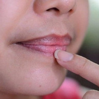 Xử lý môi thâm chỉ với 4 bước đơn giản