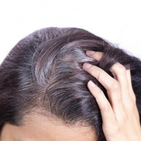 Tóc bạc sớm vì nguyên nhân không ai ngờ tới