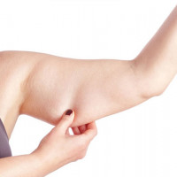 Giảm mỡ bắp tay không khó như bạn nghĩ