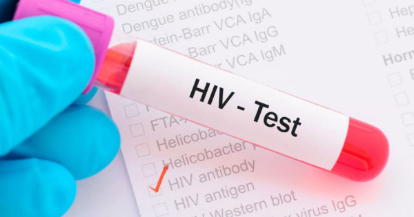 Những đối tượng nào có nguy cơ nhiễm HIV cao nhất?