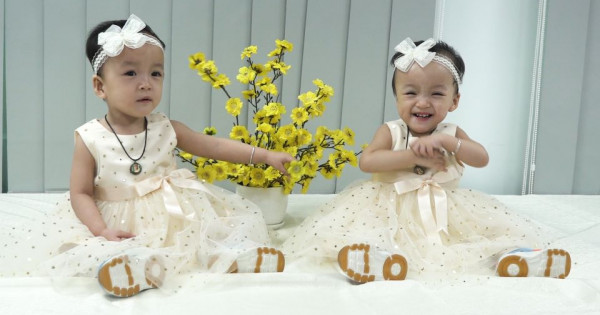 5 tháng sau ca mổ tách dính, Trúc Nhi và Diệu Nhi đã biết đi