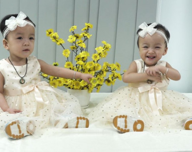 5 tháng sau ca mổ tách dính, Trúc Nhi và Diệu Nhi đã biết đi