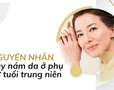 Nám da tuổi trung niên – Đâu thực sự là phương pháp điều trị hiệu quả?