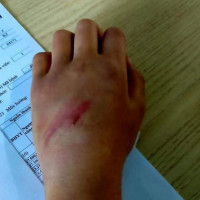 Bé trai bị cha bạo hành đến mức phải nhập viện