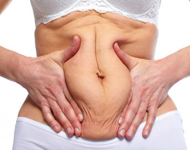 3 bước cải thiện vùng da bụng chảy xệ