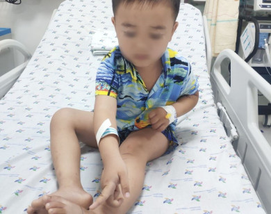 Bé trai bị rắn lục cắn trong lúc đi thả diều