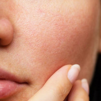 Cách thu nhỏ lỗ chân lông tại nhà