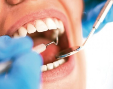 Biến chứng sau khi nhổ răng bạn không thể coi thường