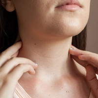 Thói quen cần có để ngăn ngừa nếp nhăn vùng cổ