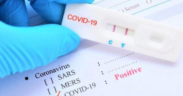 Bộ Y tế đề nghị sớm đưa kit test xét nghiệm Covid-19 vào diện bình ổn giá