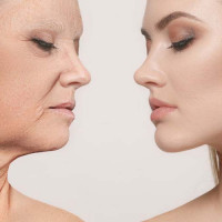 Sai lầm nghiêm trọng về chống lão hoá da bạn cần tránh