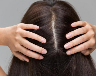 Bạn có đang chăm sóc da đầu đúng cách?