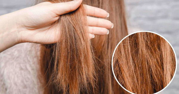 Sai lầm tai hại khiến mái tóc khô xơ xác