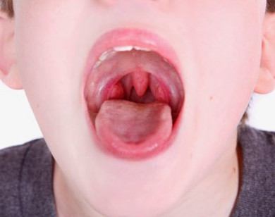 Sai lầm khi chữa viêm mũi họng cho trẻ nhiều phụ huynh hay mắc phải