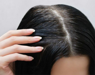 9 mẹo tuyệt vời giúp bạn chống lại tình trạng tóc bạc sớm