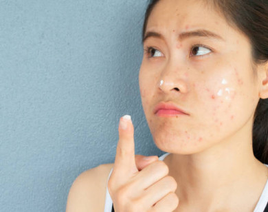 Các vấn đề thường gặp về da khi vào hè và cách khắc phục