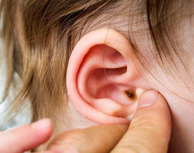 Cách phân biệt các loại viêm tai thường gặp