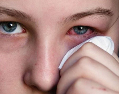 Những rủi ro bạn có thể gặp phải khi kem chống nắng dính vào mắt