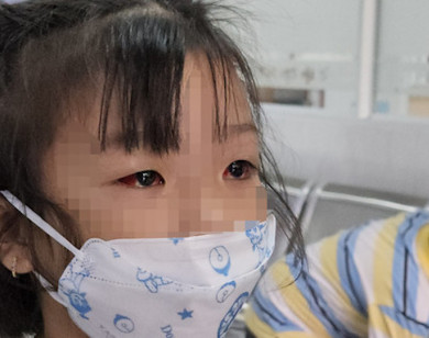 Sở Y tế TP Hồ Chí Minh nói gì về thông tin bệnh đau mắt đỏ lây qua đường nước uống?