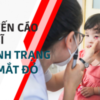 Dịch đau mắt đỏ lây lan nhanh, nhiều bệnh nhân biến chứng nặng
