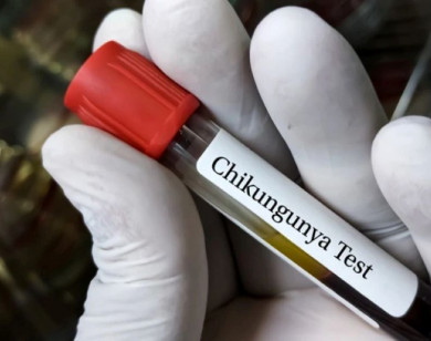 Bộ Y tế yêu cầu chủ động tăng cường phòng, chống bệnh Chikungunya