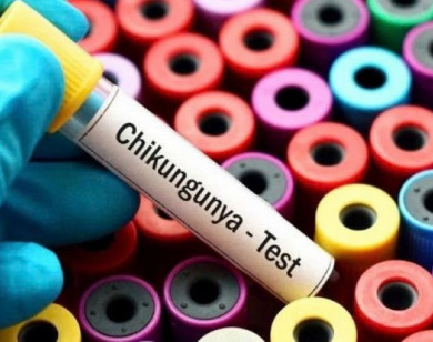 Phòng bệnh Chikungunya bằng cách nào?