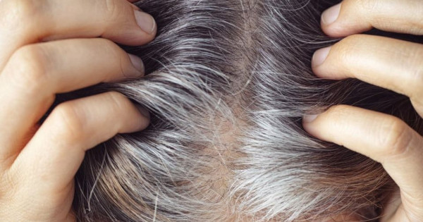 Nguyên nhân khiến tóc bạc sớm ở người trẻ